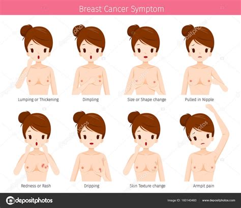 Naked Woman With Breast Cancer Symptoms Stock Vector MatoomMi