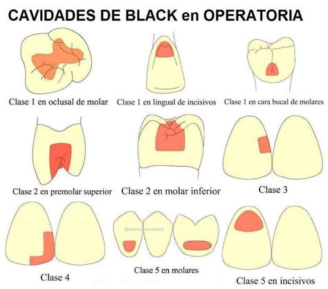 Operatoria Dental I