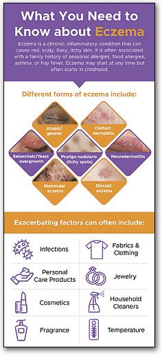 Eczema Facts Rack Card Smartpractice Dermatologyallergy