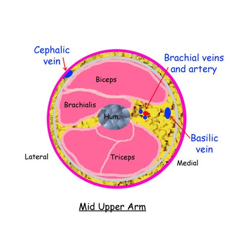 Arm Dvt Normal Ultrasoundpaedia