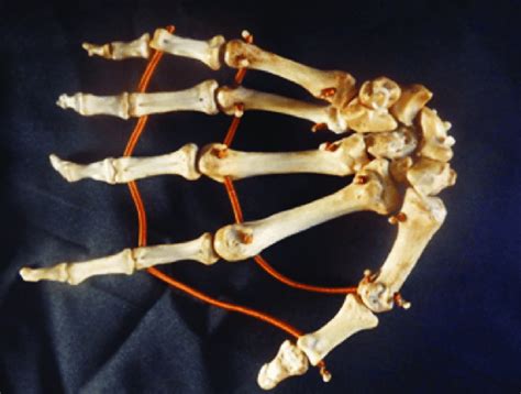 Anatomia óssea Da Mão Download Scientific Diagram