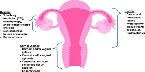 bioengineering strategies to treat female infertility tissue engineering part b reviews
