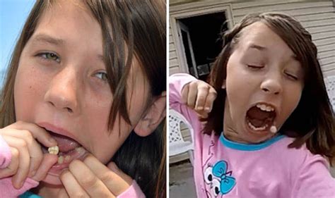 Young Girl Fires A Tooth Out Of Her Mouth With A Slingshot Weird