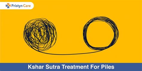 kshar sutra treatment for piles pristyn care
