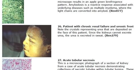 The major drawback of this simulation exam is that it only gives you a percentage correct and not a scaled score. Goljan Pathology Images and Notes pdf free download ...