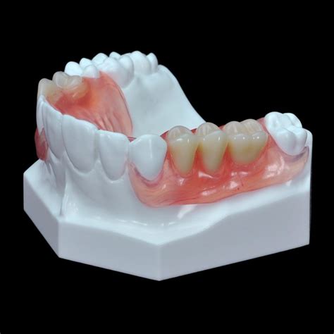 Gd 07 Flexible Partial Upper Denture Paradigm Dental Models