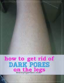 How To Get Rid Of Dark Pores On The Legs Health And Diy Ideas