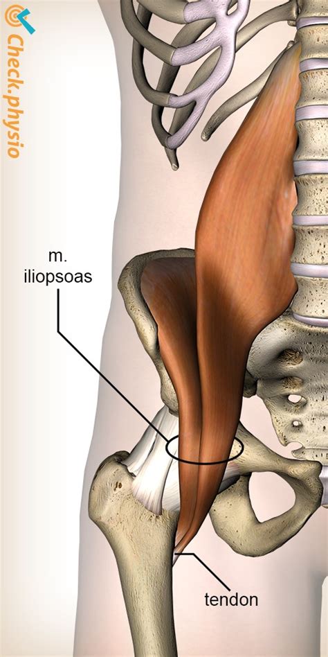 Iliopsoas Syndrome Physio Check