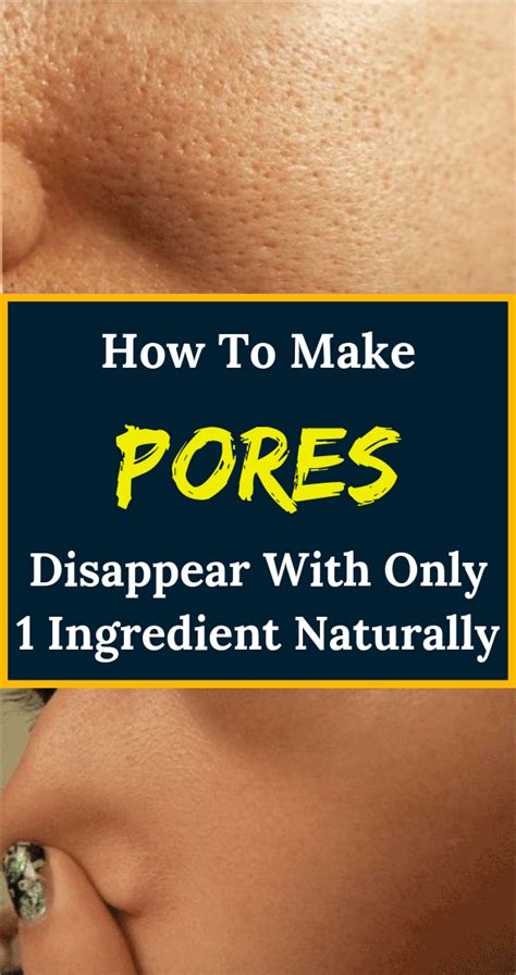 How To Close Open Pores On Your Face Wellness Today