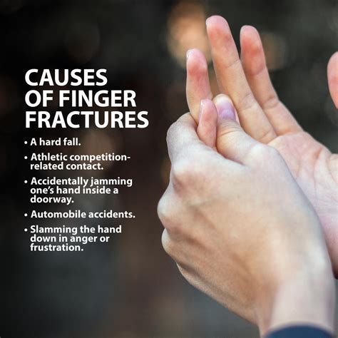 Fractured Fingers Florida Orthopaedic Institute