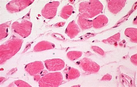 Histology Of Skeletal Muscle