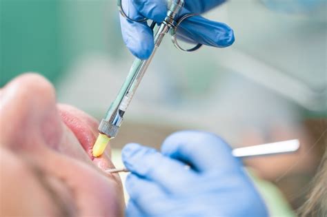 El Dentista Inyecta La Jeringa De Anestesia De Los Dientes Enfermos