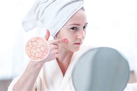 Face Adult Woman Dry Skin Circles Stock Photos Free And Royalty Free