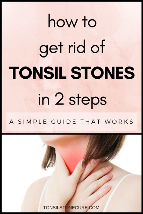 How To Prevent Tonsil Stones Formation How To Do Thing