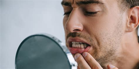 Zahnfeischr Ckgang Stoppen Tipps Von Ihrem Zahnarzt