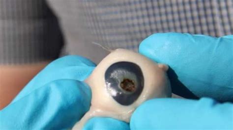 This Demonstration With A Pigs Eye Shows Why You Should Never Look At
