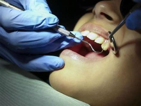 Alaska Dentist Charged With Medicaid Fraud Pulled Patients Tooth While
