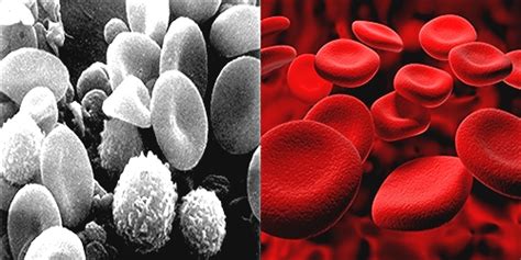 Difference Between White And Red Blood Cells Researchpediainfo