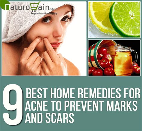 9 Best Home Remedies For Acne To Prevent Marks And Scars