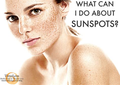 What Can I Do About Sunspots Timeless Medical Spa Beautiful Freckles Freckles Healthy Skin