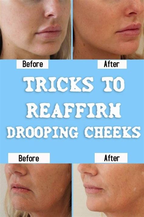 Tricks To Reaffirm Drooping Cheeks Water Retention Remedies