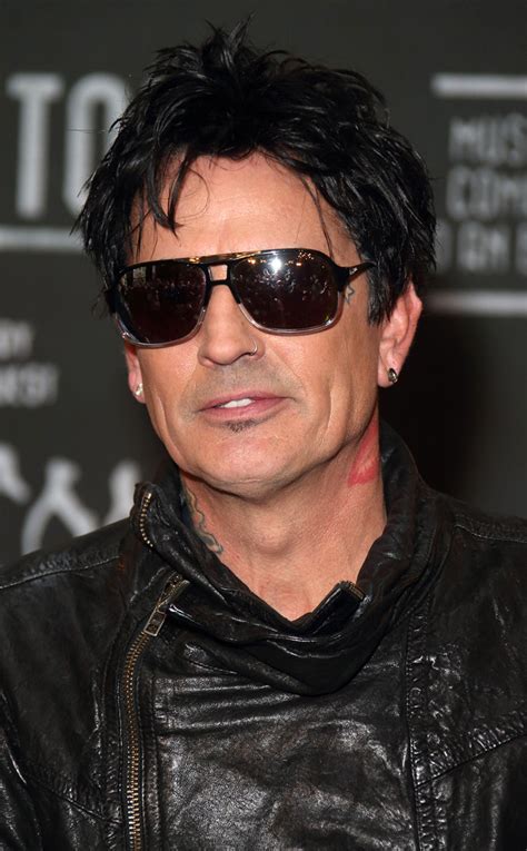 Tommy Lee Posts Photo Of Bloodied Lip After Alleged Fight With Son