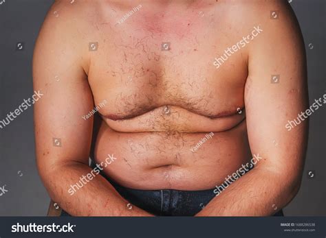 Fat Men Chest Images Stock Photos Vectors Shutterstock