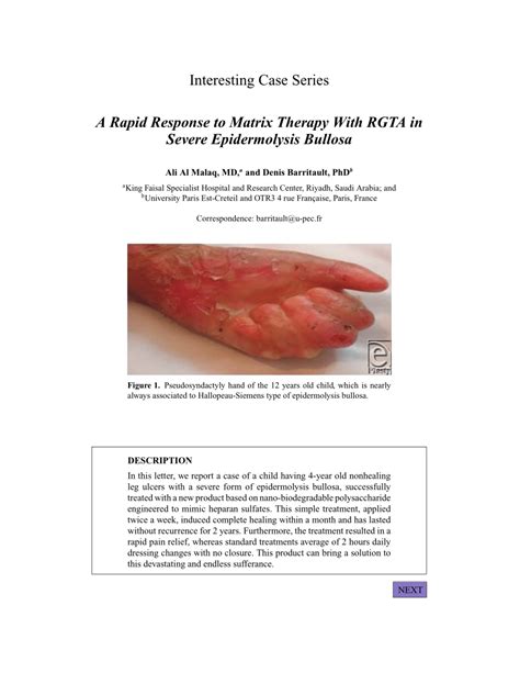 Pdf A Rapid Response To Matrix Therapy With Rgta In Severe