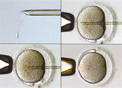 Intracytoplasmic Sperm Injection Icsi Ivf Unc Fertility