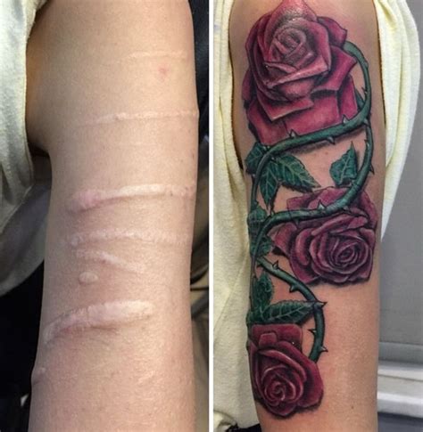 Hi katrina, yes, we should be able to improve the appearance of your burn. Is it okay to get tattoo over stitch marks? - Quora