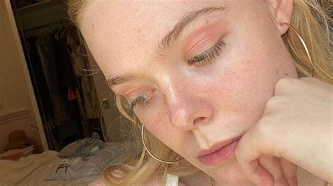 Elle Fanning Embraces Eczema In Her Latest Instagram Selfie Gma