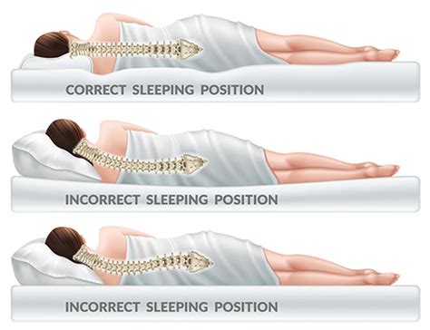Sleeping Positions For Neck And Shoulder Pain