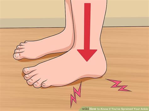 How To Know If Youve Sprained Your Ankle With Pictures