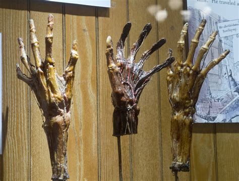 The Mütter Museums 25 Most Curious And Grotesque Medical Oddities