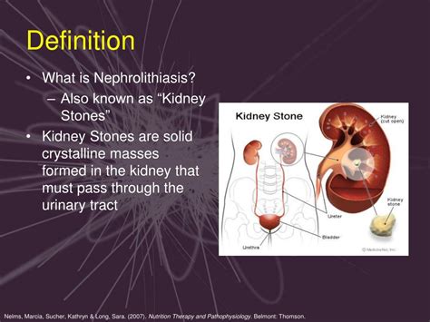 Ppt Medical Nutrition Therapy For Nephrolithiasis Powerpoint