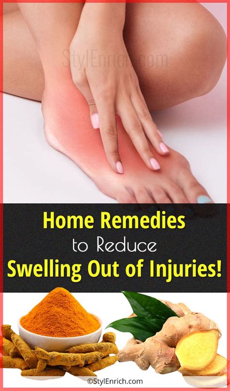 Home Remedies For Swelling Due To Injury That Will Provide Quick Relief