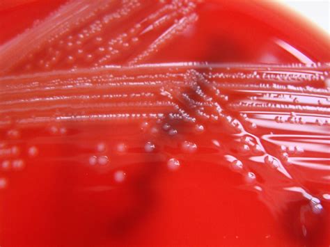Listeria Monocytogenes Columbia Horse Blood Agar Detail A Photo On