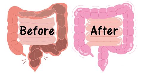 Natural Colon Cleanse: 8 Remedies To Get You Regular