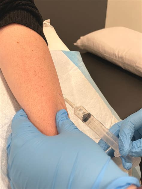 Perineural Injection Therapy — Station Street Health