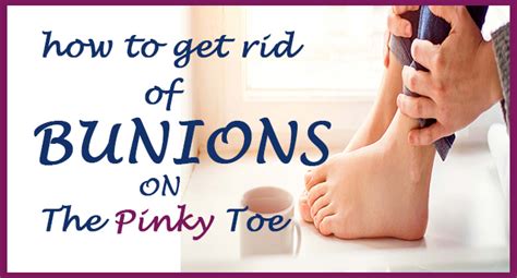 How To Get Rid Of Bunions On The Pinky Toe Remedies Lore