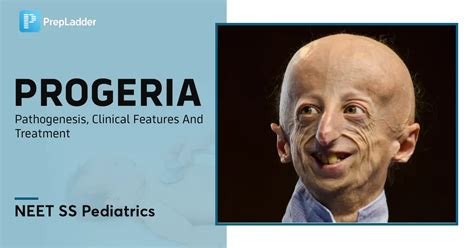 Progeria Hutchinson Gilford Progeria Syndrome Hgps Pathogenesis Clinical Features And Treatment