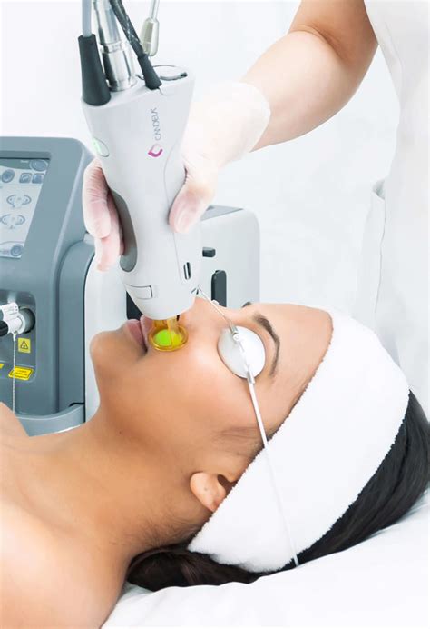 Thanaka powder, kusuma (safflower) oil. Laser Hair Removal - Queens Medical Center
