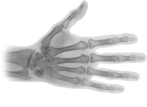 X Ray Png Transparent Images Pictures Photos Png Arts