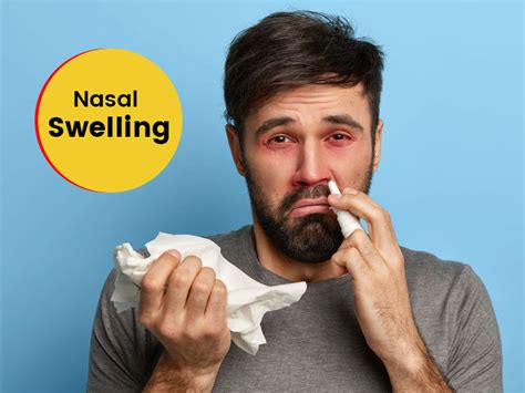 Swelling In Nose Symptoms Causes Treatment