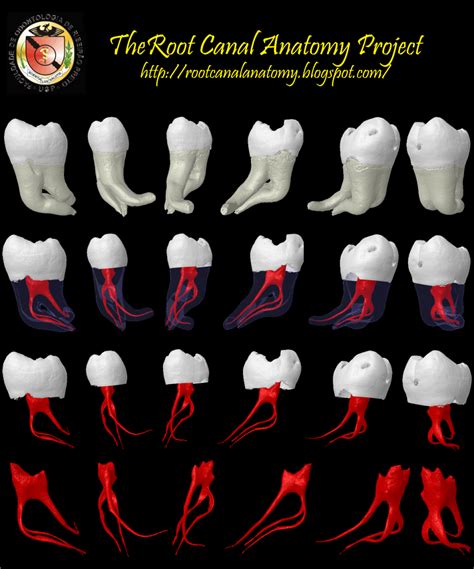 The Root Canal Anatomy Project Mandibular First Molar