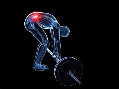 The disc often presses on a nerve root which can cause pain and other symptoms in a leg. Can I Lift Weights With A Herniated Disc?