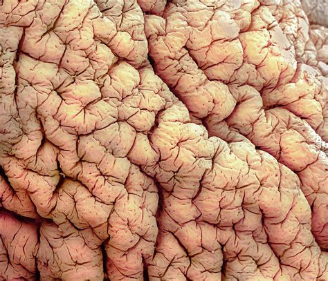 Large Intestine Photograph By Steve Gschmeissner Science Photo Library