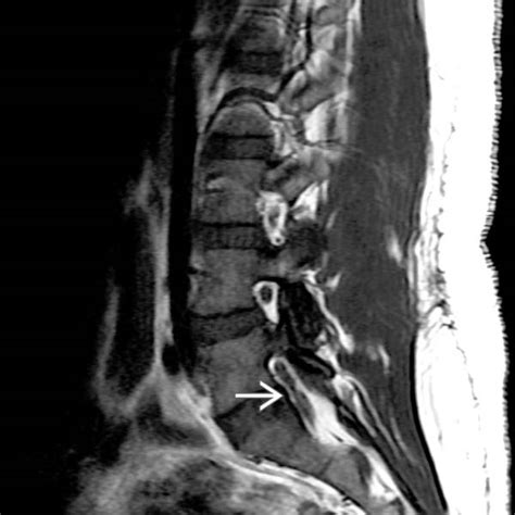 Normal Variant Radiology Key