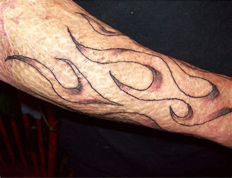 Tattoos On Burn Scars