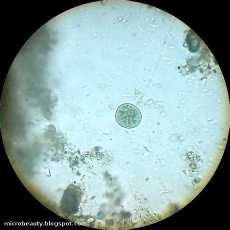 The Wonderful Microworld Microorganisms In Water
